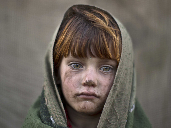 صورة مؤلمة جداً لطفل فقير